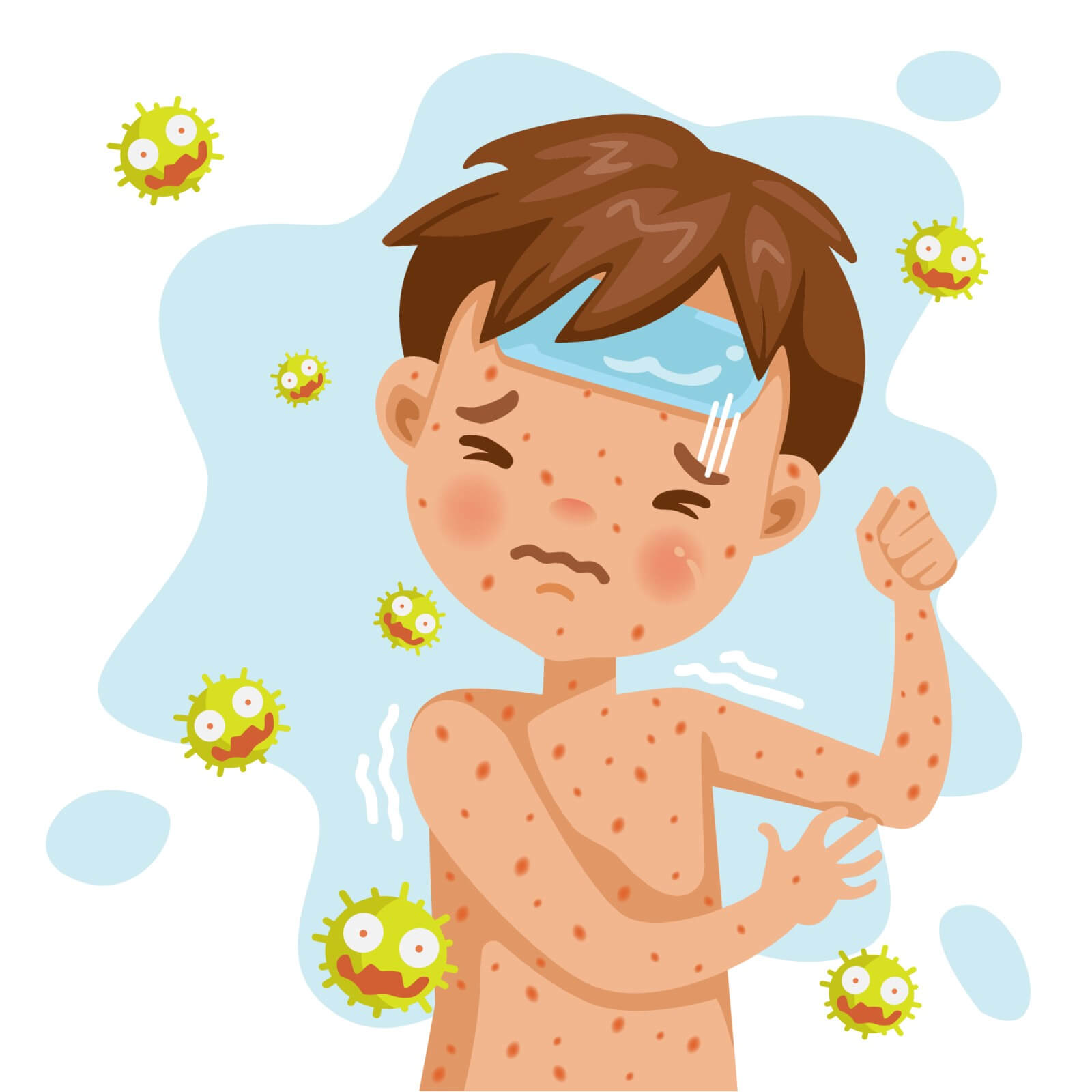 Chickenpox What You Need to Know