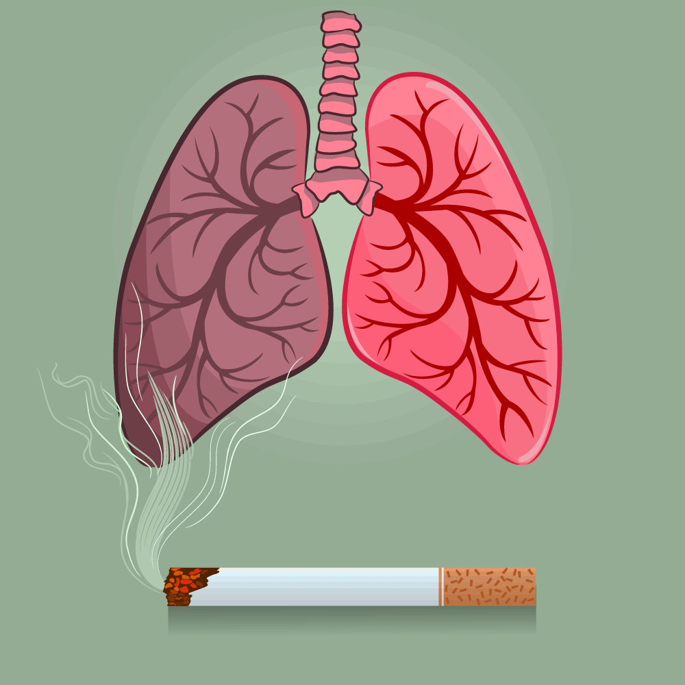 Smoking leads to disease and disability and harms nearly every body organ system. It causes cancer, heart disease, stroke, lung disease, diabetes, and chronic obstructive pulmonary disease (COPD). The earlier you quit smoking, the more you're likely to benefit. It is never too late – because quitting will improve your health, whatever your age and no matter how long you have smoked. Benefits of quitting smoking Better physical health You'll notice some benefits within days or weeks: your senses of taste and smell improve, you start to breathe more quickly you have more energy. Better blood circulation to your heart and muscles, which will make physical activity more accessible and improve lung function, leading to reductions in any cough, wheezing, or other breathing problems Your longer-term risks of cancer, lung disease, heart disease, and stroke will be significantly reduced Better mental health Stopping smoking boosts mental health and well-being. Evidence shows that after the withdrawal stage of quitting, people have reduced anxiety, depression, and stress. Quitting smoking can improve your mental health by breaking the cycle of nicotine dependence Better for your family and friends If you have stopped smoking and are physically and mentally healthy, you're more likely able to support your loved ones – and be a part of their life in the future. Also, becoming a smoke-free role model means your children are much less likely to smoke. Quitting also means protecting your loved ones from secondhand smoke, which is dangerous to anyone exposed to it, especially children. If you are having difficulty or planning on quitting smoking, you may consult a doctor via Maxicare’s 24/7 Teleconsult Hotline, Videoconsult services powered by the Doctor Anywhere App, or Maxicare Primary Care Clinic (PCC). You may also go to a PCC or request HomeCare for lab tests and diagnostic procedures. References https://www.cdc.gov/tobacco/campaign/tips/quit-smoking/index.html https://www.nhs.uk/better-health/quit-smoking/benefits-of-quitting-smoking/ 